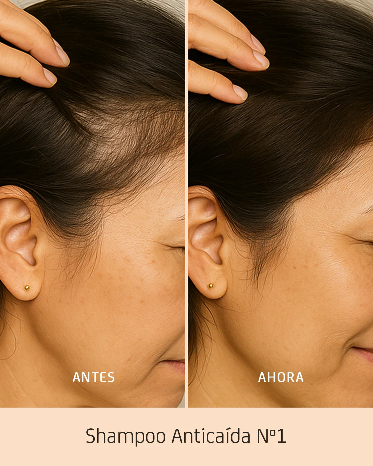 shampoo para la caída del cabello en Quito shampoo para la caída del cabello en Quito