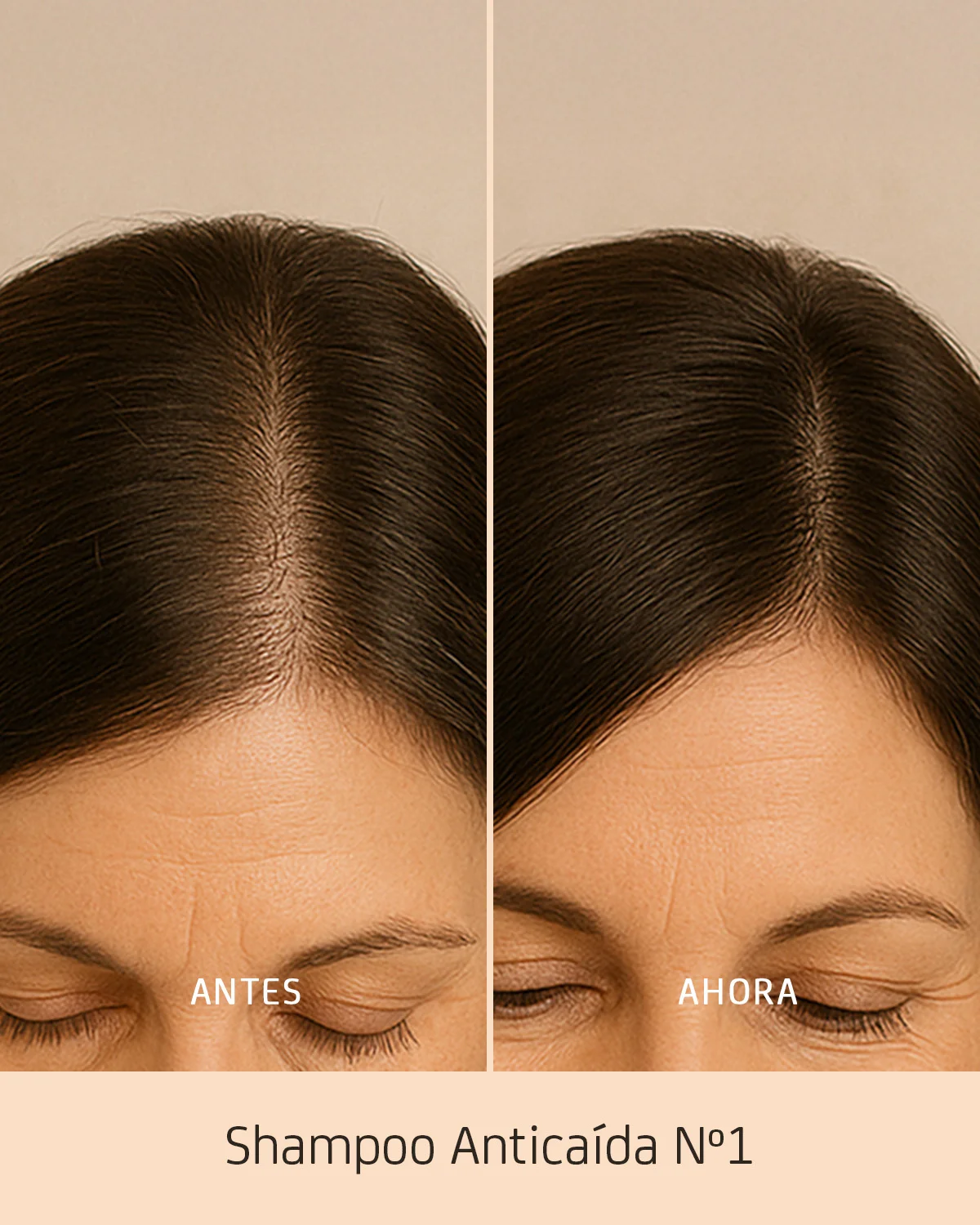 shampoo para la caída del cabello en Guayaquil shampoo para la caída del cabello en Guayaquil