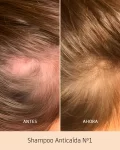 Shampoo Anticaída N1 para cabello Normal a Graso
