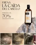 Shampoo Anticaída N1 para cabello Normal a Graso