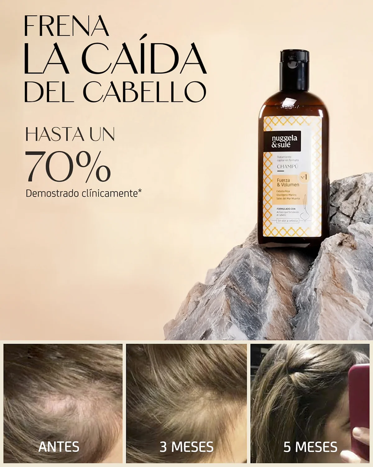 shampoo de cebolla para la caida del cabello shampoo de cebolla para la caida del cabello