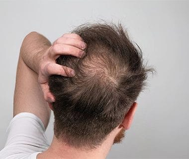 Tipos de cabello, ¿cuál es el tuyo? Haz el test