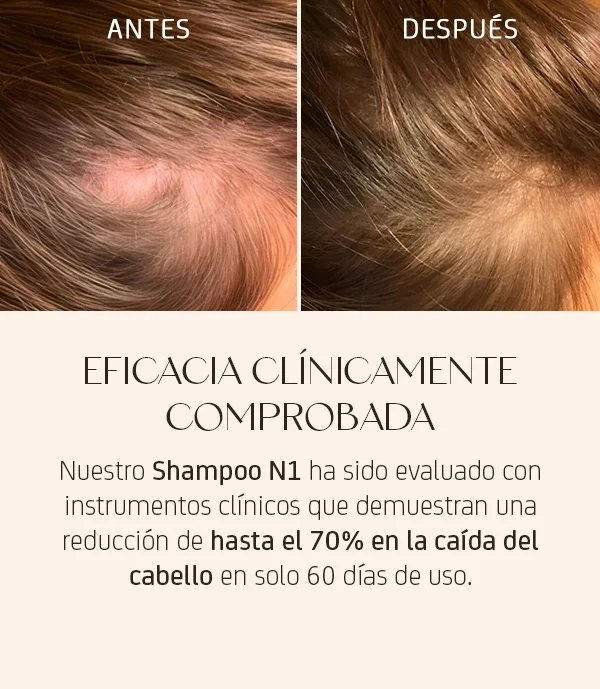 Nuggela sule eficacia clínicamente probada Nuggela sule eficacia clínicamente probada