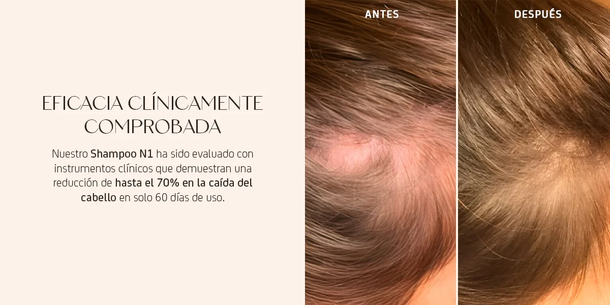 Nuggela sule eficacia clínicamente probada Nuggela sule eficacia clínicamente probada